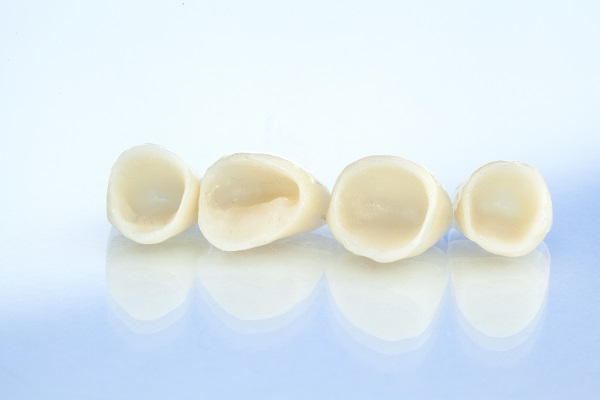 When Are Dental Crowns Recommended By Dentists?