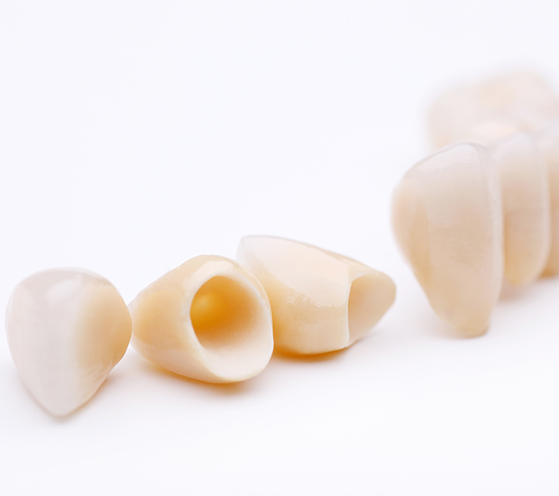 Big Stone Gap Dental Crowns and Dental Bridges