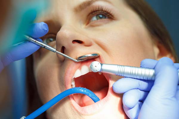 Dental Restoration Options For Damaged Teeth