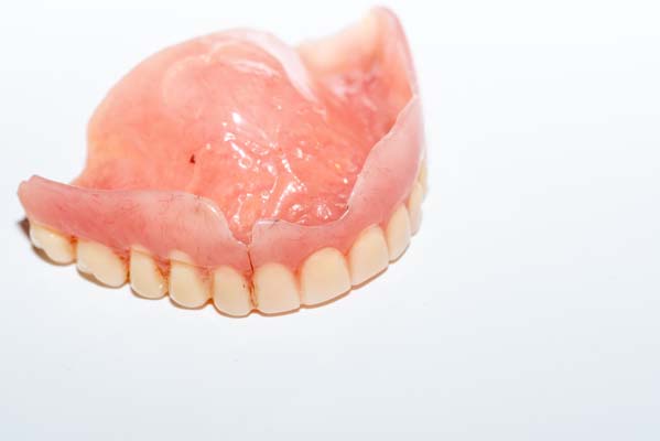 What Is A Denture Reline?