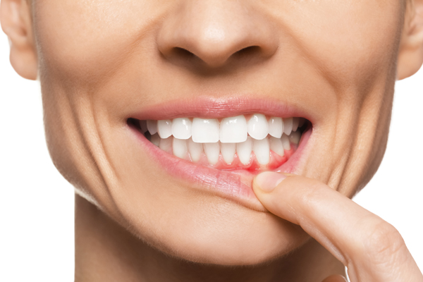 Could Gum Disease Be A Sign Of Another Condition?