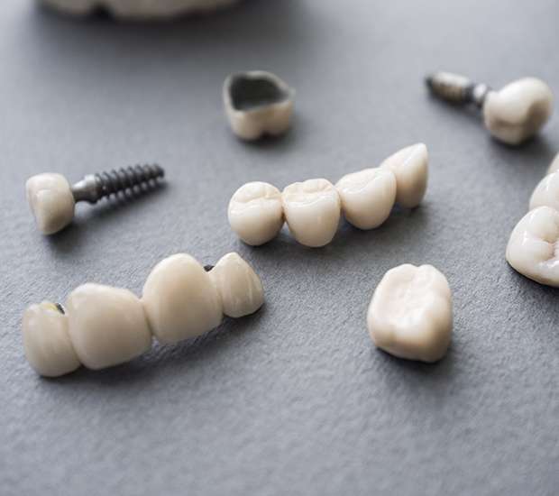 Big Stone Gap The Difference Between Dental Implants and Mini Dental Implants