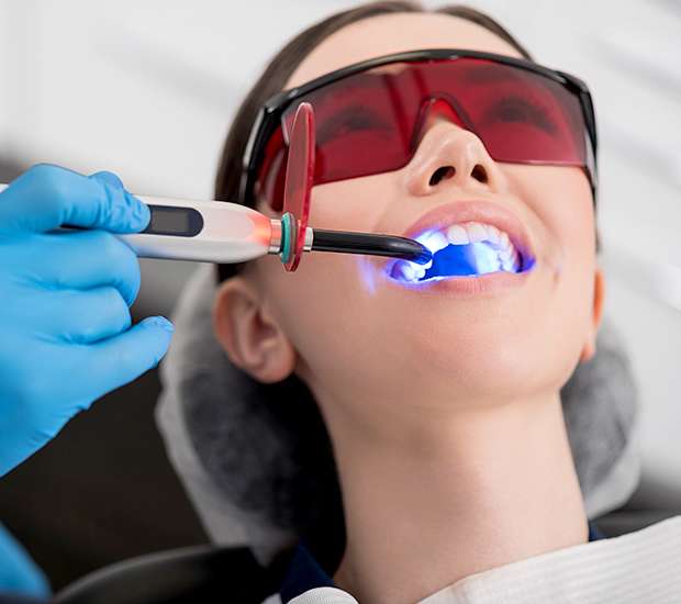 Big Stone Gap Professional Teeth Whitening